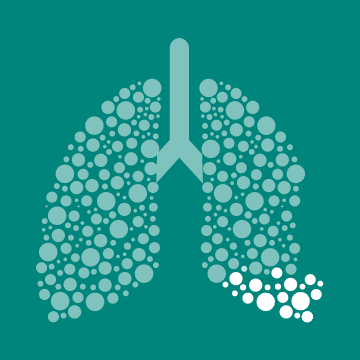 Imagem 15% Cancro Pulmão de células pequenas